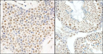 Rabbit anti-E1B-AP5 Antibody, Affinity Purified