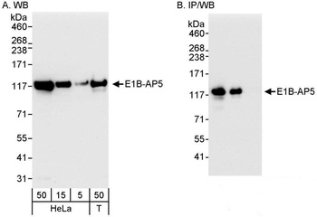 Rabbit anti-E1B-AP5 Antibody, Affinity Purified