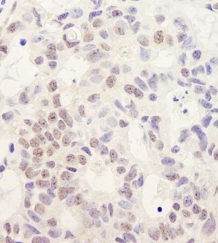 Rabbit anti-DHX38 Antibody, Affinity Purified