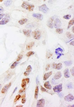 Rabbit anti-DHX38 Antibody, Affinity Purified