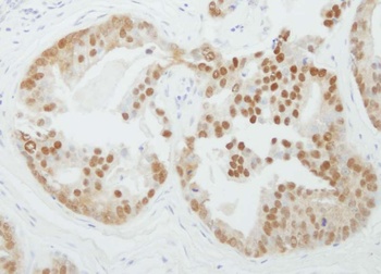 Rabbit anti-PRMT5 Antibody, Affinity Purified