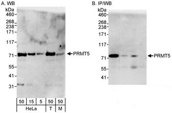 Rabbit anti-PRMT5 Antibody, Affinity Purified