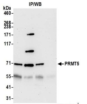 Rabbit anti-PRMT5 Antibody, Affinity Purified