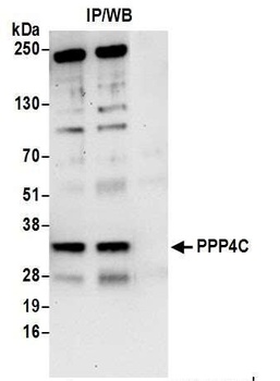 Rabbit anti-PPP4C Antibody, Affinity Purified