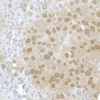 Rabbit anti-PPP4C Antibody, Affinity Purified