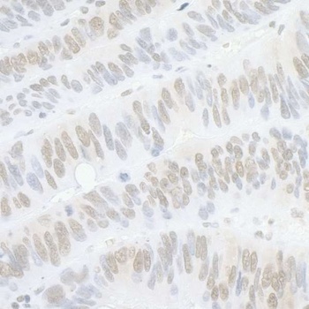 Rabbit anti-PPP4C Antibody, Affinity Purified