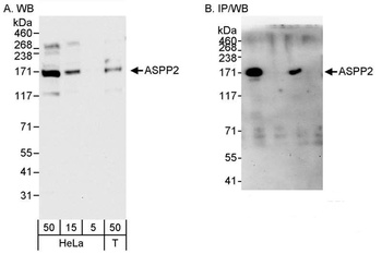 Rabbit anti-ASPP2 Antibody, Affinity Purified