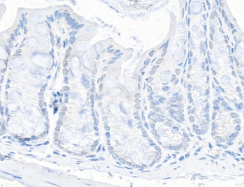 Rabbit anti-TIF1 Alpha/TRIM24 Antibody, Affinity Purified