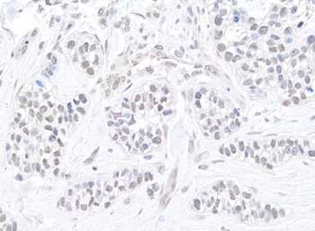 Rabbit anti-TIF1 Alpha/TRIM24 Antibody, Affinity Purified