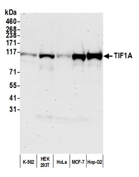 Rabbit anti-TIF1 Alpha/TRIM24 Antibody, Affinity Purified