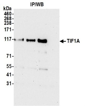 Rabbit anti-TIF1 Alpha/TRIM24 Antibody, Affinity Purified