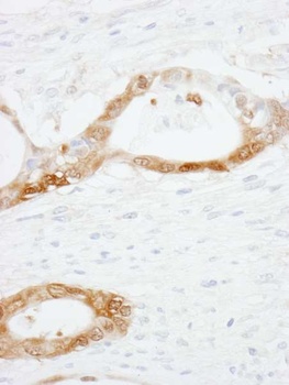 Rabbit anti-CRABP2 Antibody, Affinity Purified