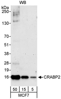 Rabbit anti-CRABP2 Antibody, Affinity Purified