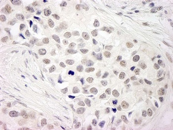 Rabbit anti-NCOA5/CIA Antibody, Affinity Purified