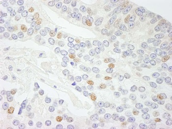 Rabbit anti-NCOA5/CIA Antibody, Affinity Purified