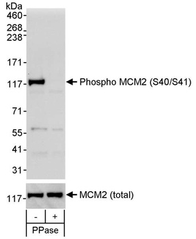 Rabbit anti-Phospho MCM2 (S40/S41) Antibody, Affinity Purified