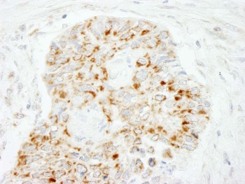 Rabbit anti-MAVS/VISA Antibody, Affinity Purified