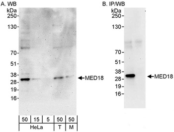 Rabbit anti-MED18 Antibody, Affinity Purified