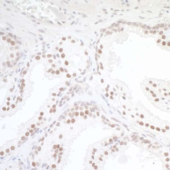 Rabbit anti-TORC1 Antibody, Affinity Purified