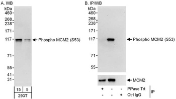 Rabbit anti-Phospho MCM2 (S53) Antibody, Affinity Purified