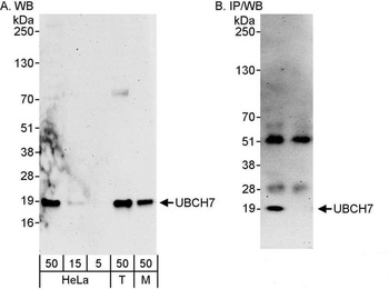 Rabbit anti-UBCH7 Antibody, Affinity Purified