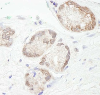 Rabbit anti-UBCH7 Antibody, Affinity Purified