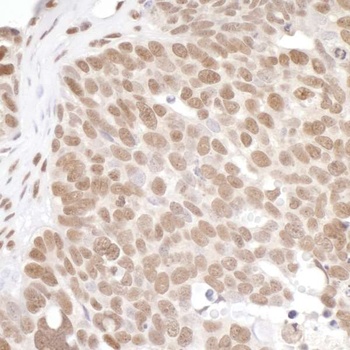 Rabbit anti-PRMT1 Antibody, Affinity Purified