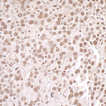 Rabbit anti-PRMT1 Antibody, Affinity Purified
