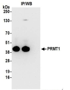 Rabbit anti-PRMT1 Antibody, Affinity Purified