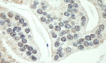 Rabbit anti-RNF40 Antibody, Affinity Purified