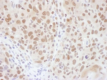 Rabbit anti-RNF20 Antibody, Affinity Purified