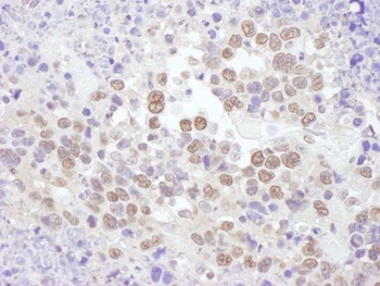 Rabbit anti-RNF20 Antibody, Affinity Purified