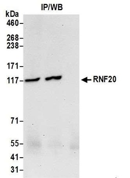 Rabbit anti-RNF20 Antibody, Affinity Purified