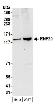 Rabbit anti-RNF20 Antibody, Affinity Purified