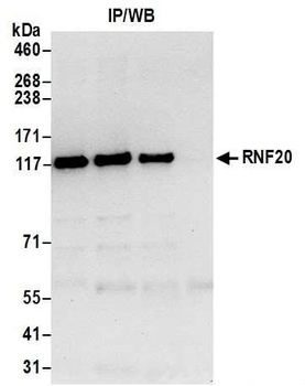 Rabbit anti-RNF20 Antibody, Affinity Purified