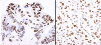 Rabbit anti-Nucleolin (NCL) Antibody, Affinity Purified