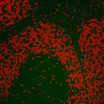 Rabbit anti-Nucleolin (NCL) Antibody, Affinity Purified