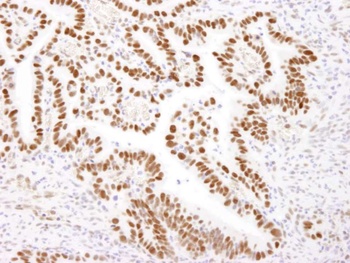 Rabbit anti-Nucleolin (NCL) Antibody, Affinity Purified