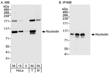 Rabbit anti-Nucleolin (NCL) Antibody, Affinity Purified