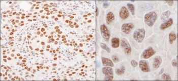 Rabbit anti-hnRNP-U Antibody, Affinity Purified