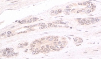 Rabbit anti-ATRIP Antibody, Affinity Purified