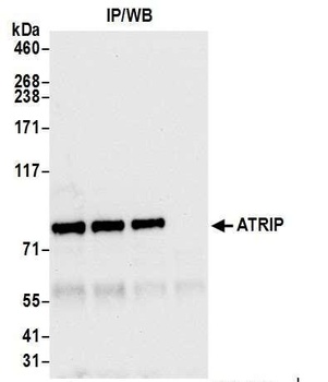 Rabbit anti-ATRIP Antibody, Affinity Purified