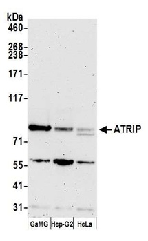 Rabbit anti-ATRIP Antibody, Affinity Purified
