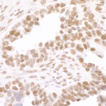 Rabbit anti-Phospho RNA Polymerase II (S2) Antibody, Affinity Purified