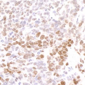 Rabbit anti-Phospho RNA Polymerase II (S2) Antibody, Affinity Purified
