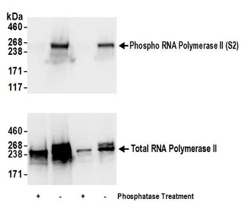 Rabbit anti-Phospho RNA Polymerase II (S2) Antibody, Affinity Purified