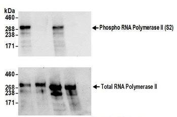 Rabbit anti-Phospho RNA Polymerase II (S2) Antibody, Affinity Purified