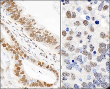 Rabbit anti-Phospho 53BP1 (S25) Antibody, Affinity Purified