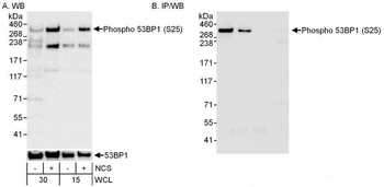 Rabbit anti-Phospho 53BP1 (S25) Antibody, Affinity Purified