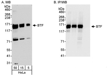 Rabbit anti-BTF Antibody, Affinity Purified